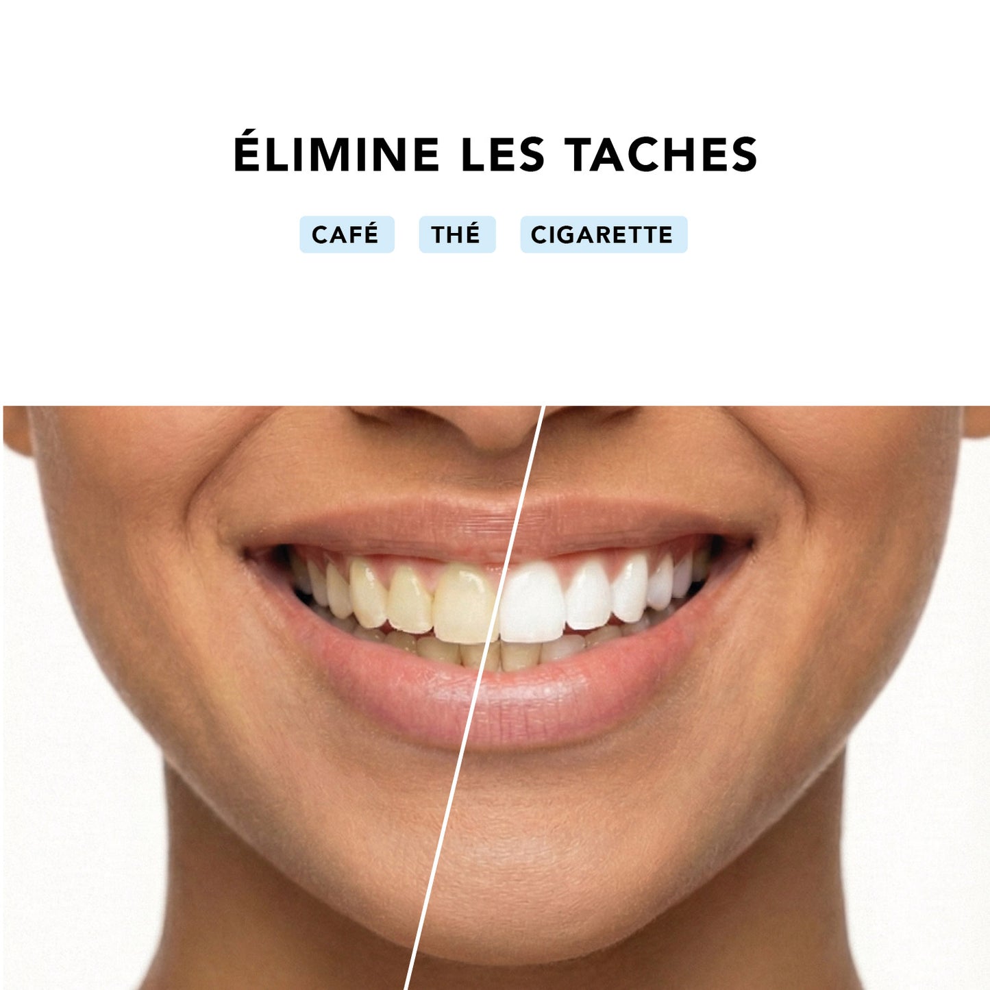 Bandes de blanchiment dentaire