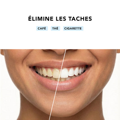 Bandes de blanchiment dentaire