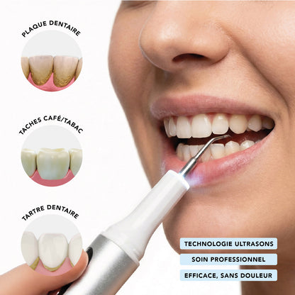 Nettoyant Antitartre Dentaire